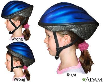 3 Images Showing Correct and Incorrect Helmet Positions